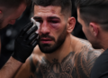 Preocupación por Illia Topuria tras su derrota ante Gaethje: se teme por una posible fractura orbital
