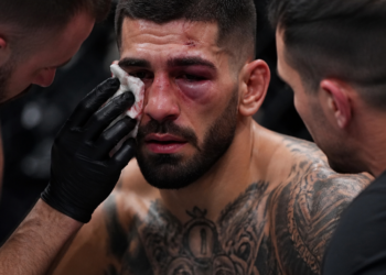 Preocupación por Illia Topuria tras su derrota ante Gaethje: se teme por una posible fractura orbital
