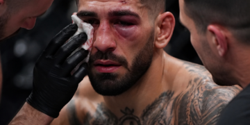 Preocupación por Illia Topuria tras su derrota ante Gaethje: se teme por una posible fractura orbital